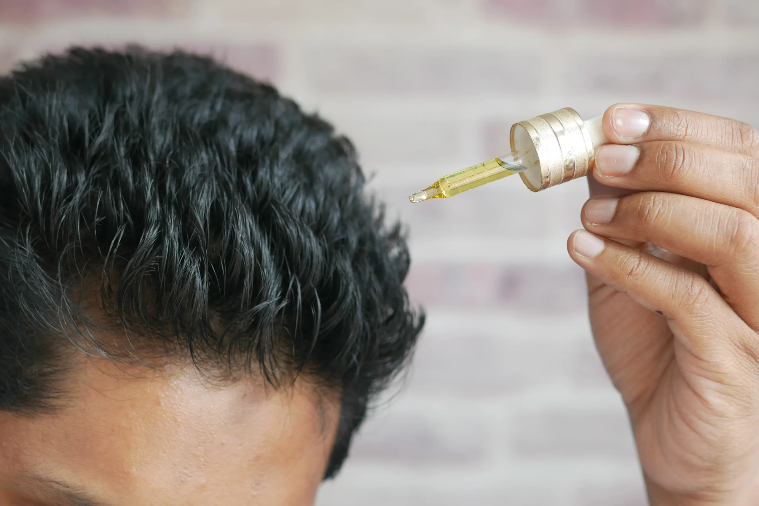 Minoxidil for Hair Growth: Pros, Cons, and Results