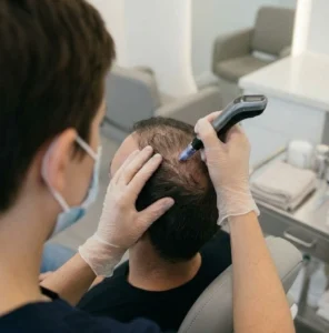 Microneedling Possible Benefits for Hair Loss